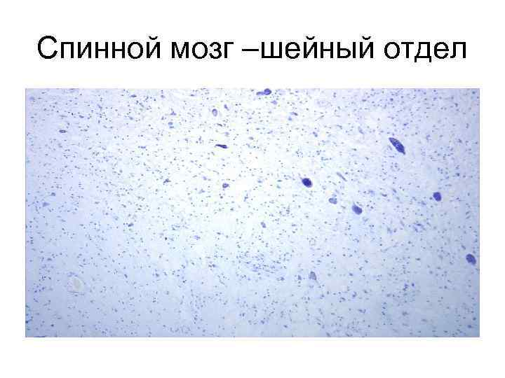 Спинной мозг –шейный отдел 
