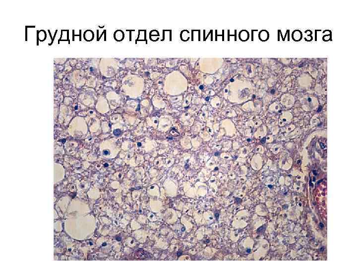 Грудной отдел спинного мозга 
