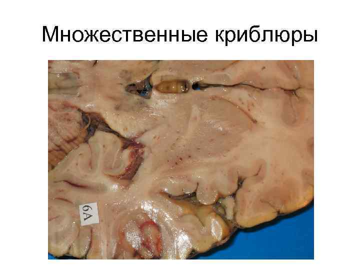 Множественные криблюры 