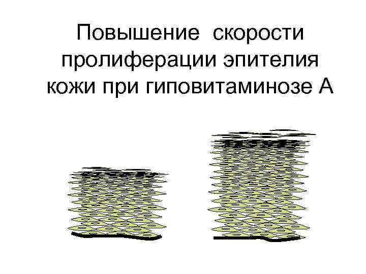 Повышение скорости пролиферации эпителия кожи при гиповитаминозе А 