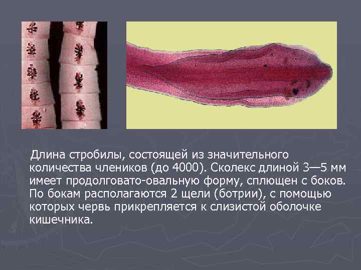  Длина стробилы, состоящей из значительного количества члеников (до 4000). Сколекс длиной 3— 5