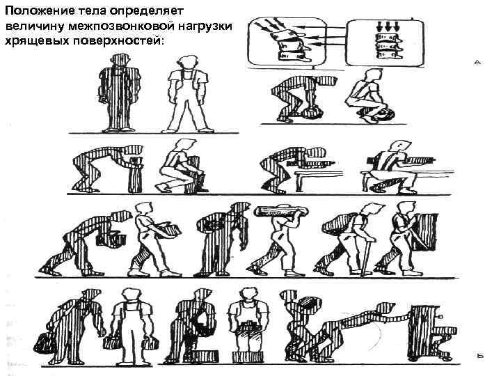 Положение тела определяет величину межпозвонковой нагрузки хрящевых поверхностей: 