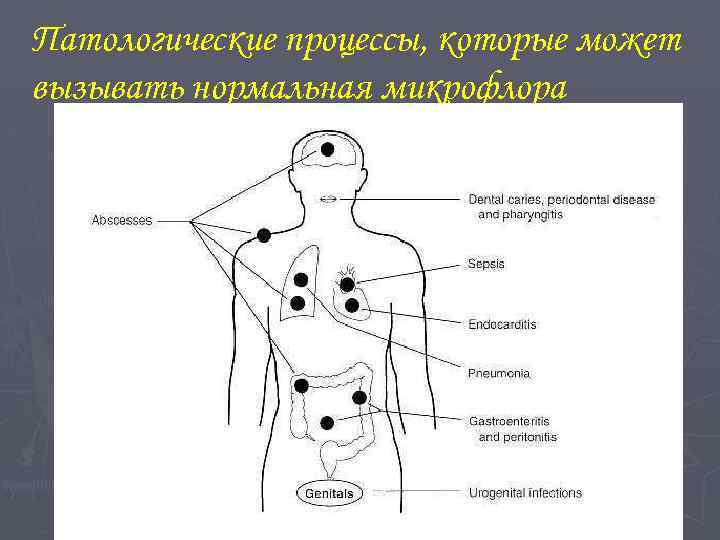 Патологические процессы, которые может вызывать нормальная микрофлора 
