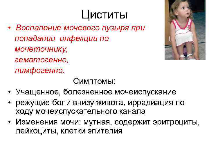 Циститы • Воспаление мочевого пузыря при попадании инфекции по мочеточнику, гематогенно, лимфогенно. Симптомы: •