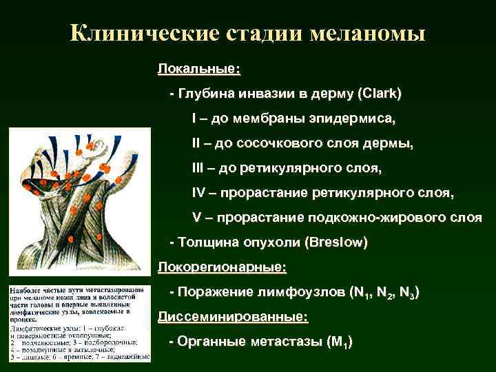 Клинические стадии меланомы Локальные: - Глубина инвазии в дерму (Clark) I – до мембраны