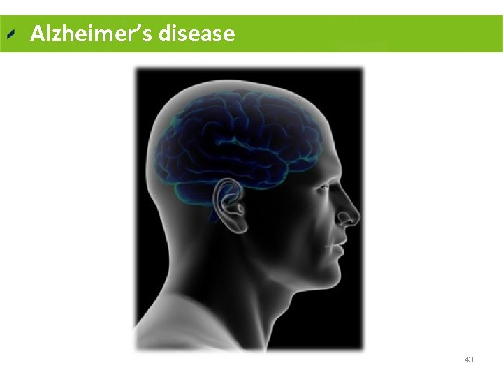 Alzheimer’s disease 40 