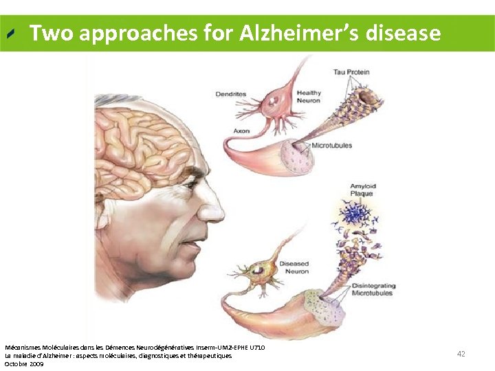 Two approaches for Alzheimer’s disease Mécanismes Moléculaires dans les Démences Neurodégénératives Inserm-UM 2 -EPHE