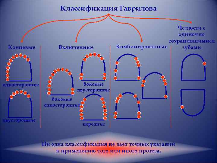 Включи конечную. Дефекты зубных рядов Гаврилова. Классификация Гаврилова частичных дефектов. Классификация Гаврилову дефекты зубного ряда. Классификация зубных рядов по Гаврилову.