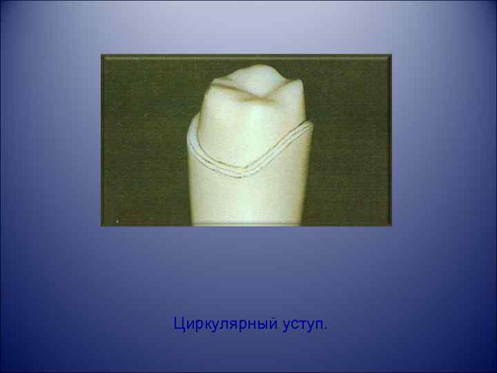 Циркулярный уступ. 