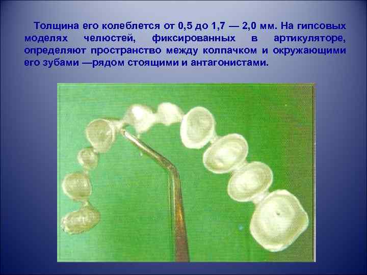  Толщина его колеблется от 0, 5 до 1, 7 — 2, 0 мм.