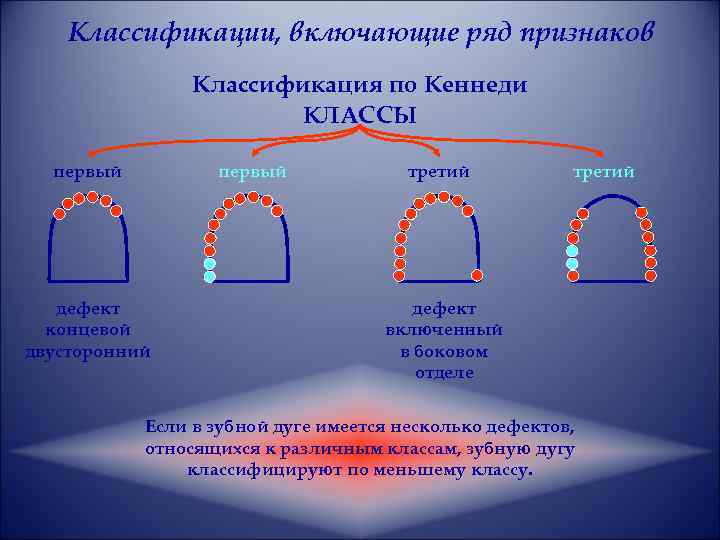 Дефекты зубных рядов. 2 Класс 1 подкласс по Кеннеди. Классификация зубных дефектов по Кеннеди. 3 Класс 3 подкласс по Кеннеди. Дефекты зубных рядов по Кеннеди и Гаврилову.