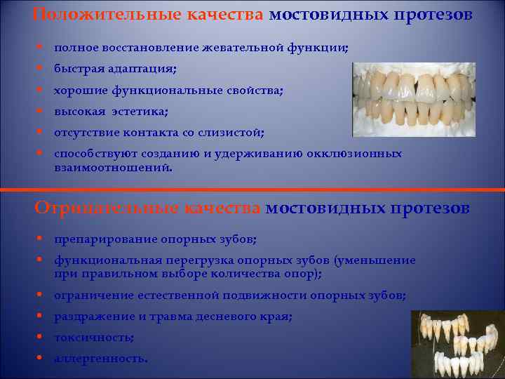 Полное восстановление. Положительные и отрицательные стороны мостовидных протезов. Функции мостовидных протезов. Восстановление жевательной функции. Критерии качества мостовидного протеза.