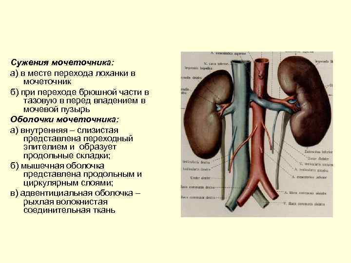 Сужения мочеточника: а) в месте перехода лоханки в мочеточник б) при переходе брюшной части