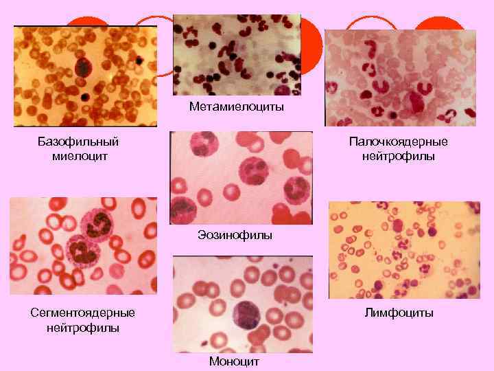 Метамиелоциты Базофильный миелоцит Палочкоядерные нейтрофилы Эозинофилы Сегментоядерные нейтрофилы Лимфоциты Моноцит 