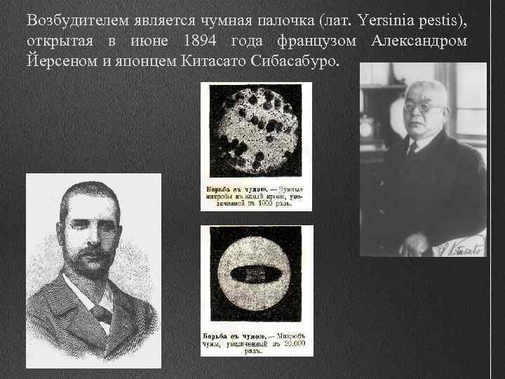 Возбудителем является чумная палочка (лат. Yersinia pestis), открытая в июне 1894 года французом Александром