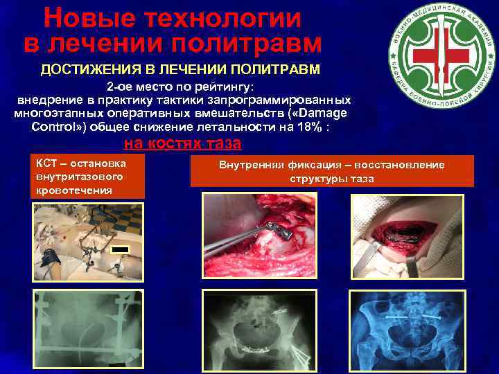 Новые технологии в лечении политравм ДОСТИЖЕНИЯ В ЛЕЧЕНИИ ПОЛИТРАВМ 2 -ое место по рейтингу: