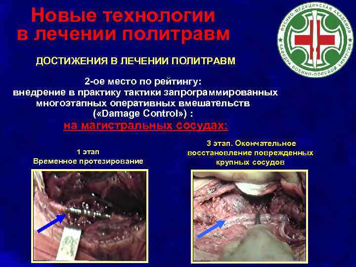 Новые технологии в лечении политравм ДОСТИЖЕНИЯ В ЛЕЧЕНИИ ПОЛИТРАВМ 2 -ое место по рейтингу: