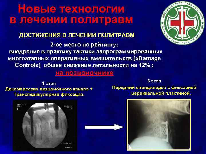 Новые технологии в лечении политравм ДОСТИЖЕНИЯ В ЛЕЧЕНИИ ПОЛИТРАВМ 2 -ое место по рейтингу: