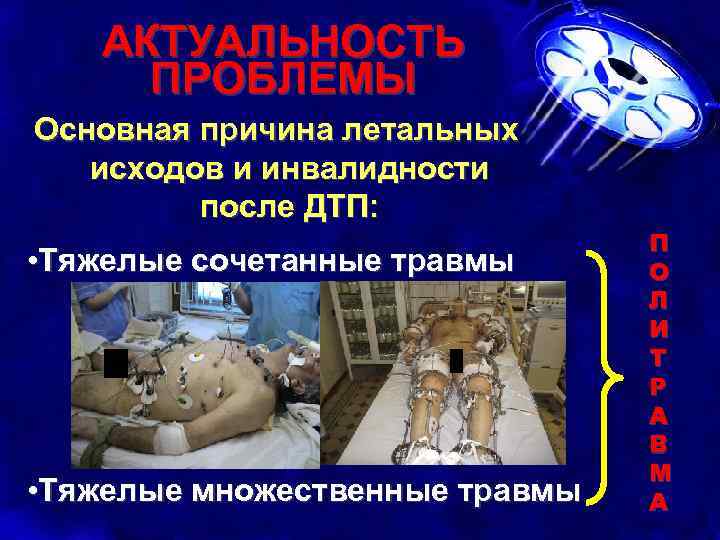 АКТУАЛЬНОСТЬ ПРОБЛЕМЫ Основная причина летальных исходов и инвалидности после ДТП: • Тяжелые сочетанные травмы
