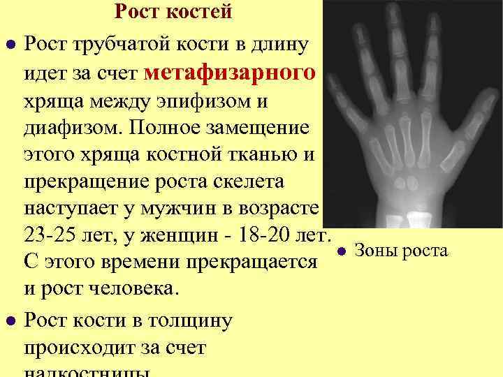 l l Рост костей Рост трубчатой кости в длину идет за счет метафизарного хряща