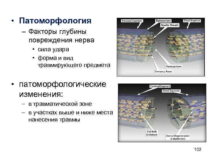  • Патоморфология – Факторы глубины повреждения нерва • сила удара • форма и