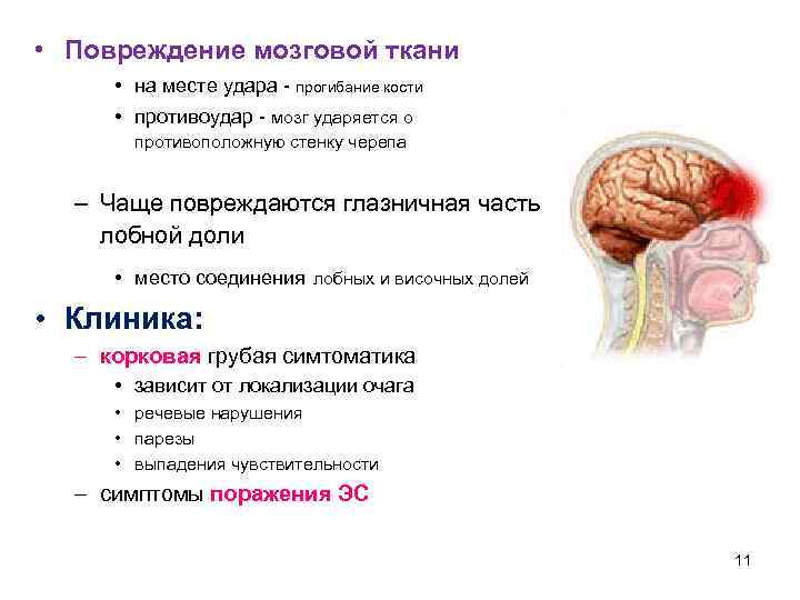  • Повреждение мозговой ткани • на месте удара - прогибание кости • противоудар