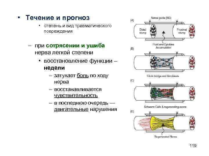  • Течение и прогноз • степень и вид травматического повреждения – при сотрясении