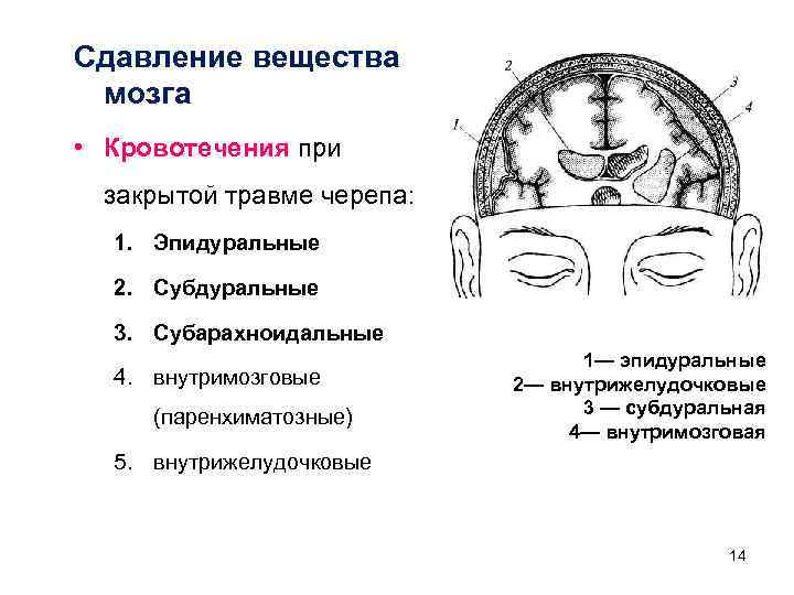 Сдавление мозга признаки. Сдавления вещества мозга. Сдавление головного мозга. Травмы головного и спинного мозга.