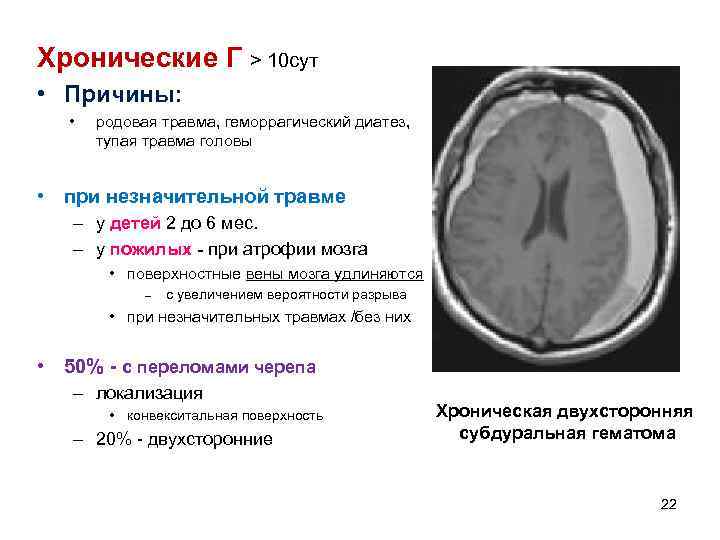 Хронические Г > 10 сут • Причины: • родовая травма, геморрагический диатез, тупая травма