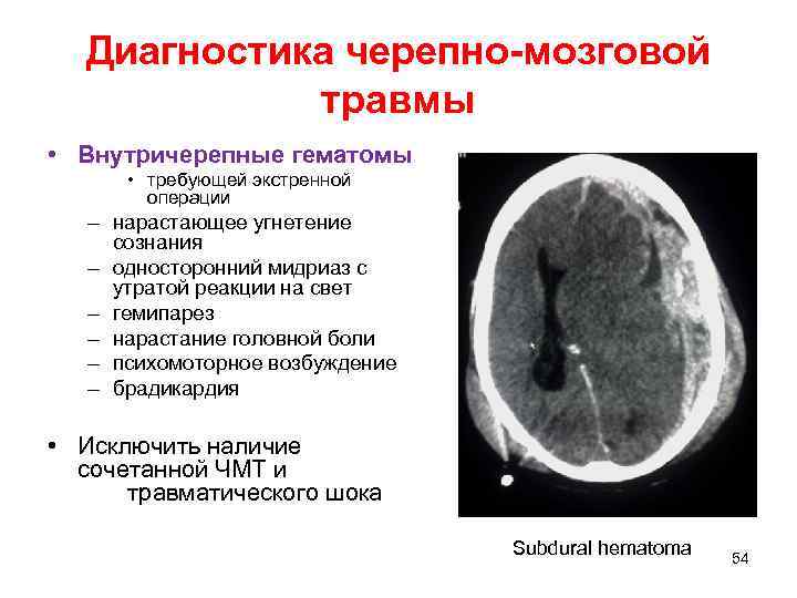 Черепно мозговая травма хирургия презентация