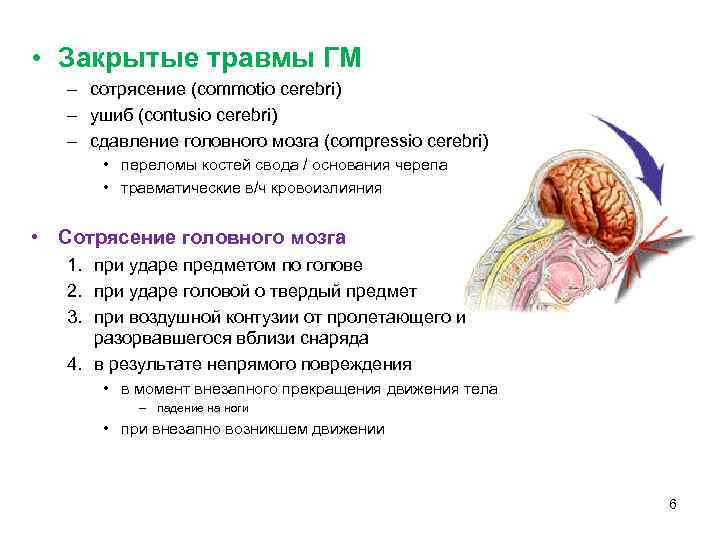  • Закрытые травмы ГМ – сотрясение (commotio cerebri) – ушиб (contusio cerebri) –