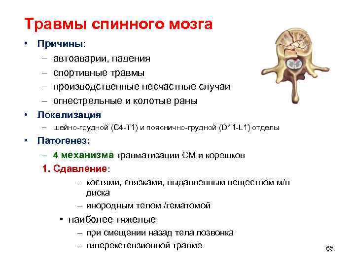 Причины повреждение мозга. Повреждение спинного мозга симптомы. Причины травм спинного мозга. Причины повреждения спинного мозга. Патогенез травмы спинного мозга.