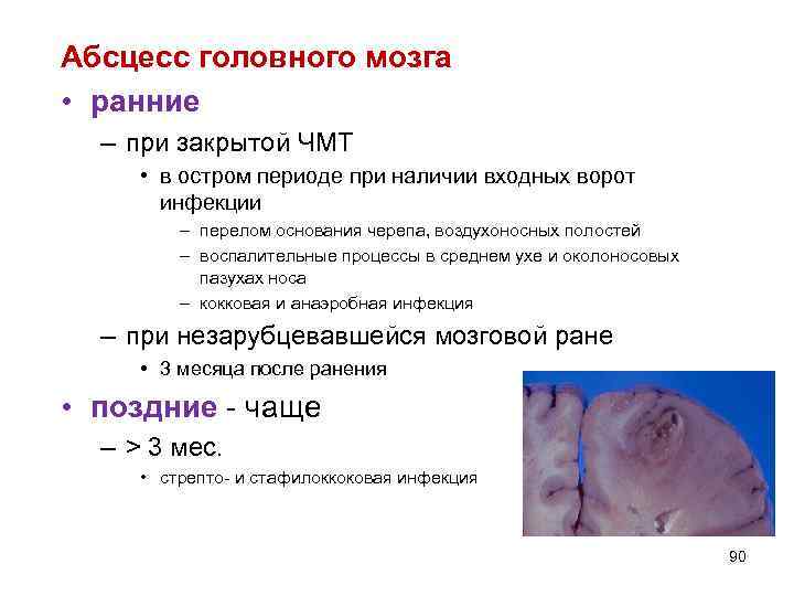 Абсцесс головного мозга • ранние – при закрытой ЧМТ • в остром периоде при