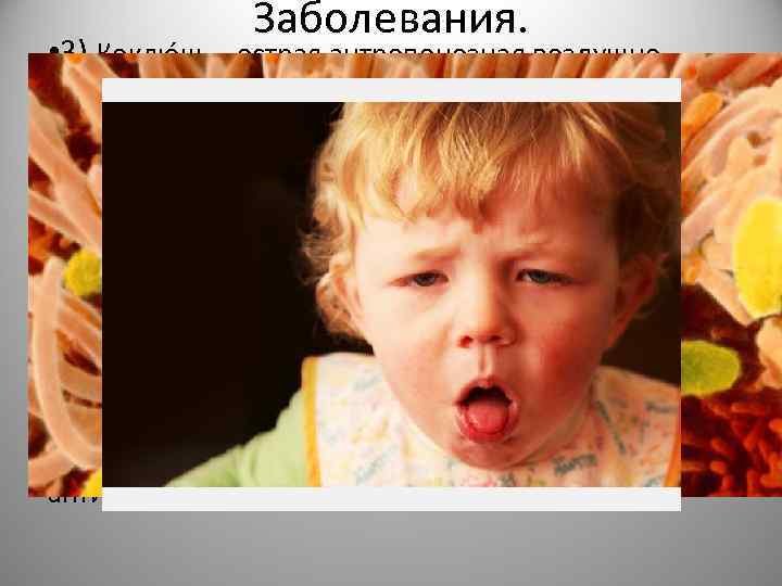 Заболевания. • 3) Коклю ш— острая антропонозная воздушно- капельная бактериальная инфекция, наиболее характерным признаком
