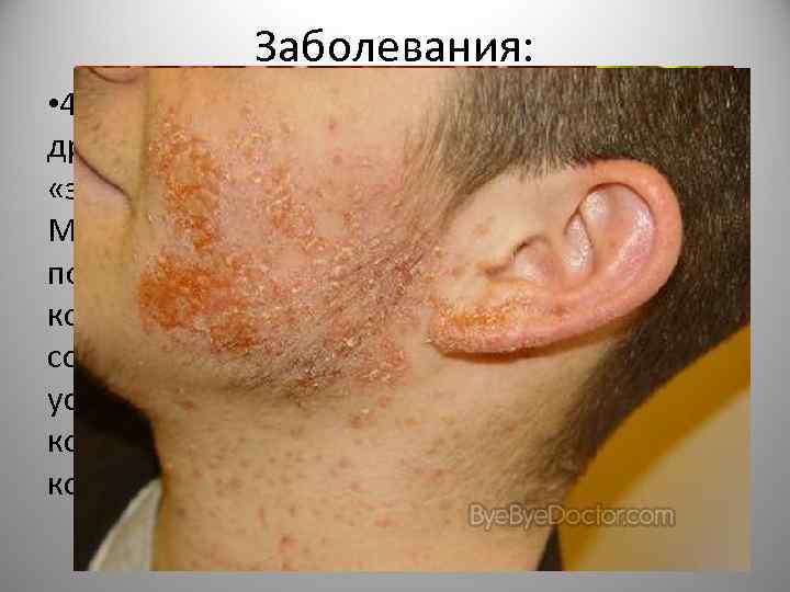 Заболевания: • 4) Стафилококк (новолат. Staphylococcus, от др. -греч. σταφυλή, «виноград» и κόκκος -