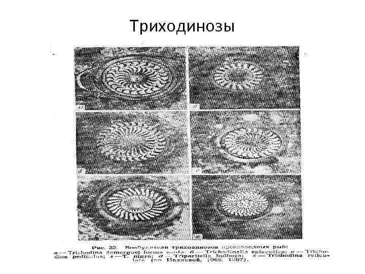 Триходинозы 