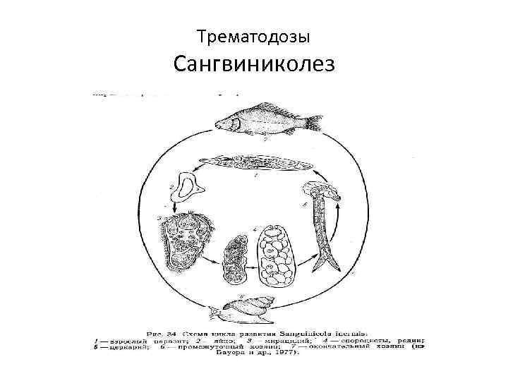 Трематодозы Сангвиниколез 