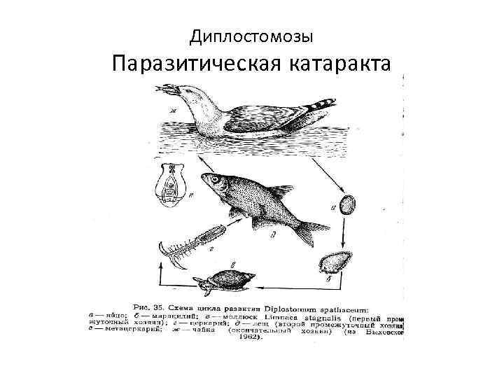 Диплостомозы Паразитическая катаракта 