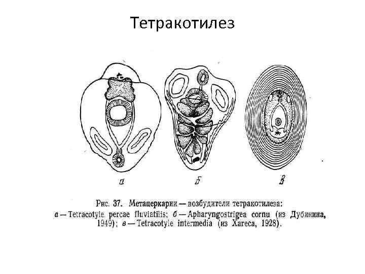 Тетракотилез 