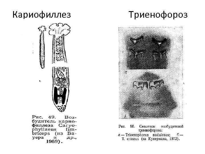 Кариофиллез Триенофороз 
