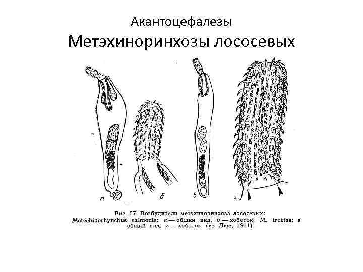 Акантоцефалезы Метэхиноринхозы лососевых 