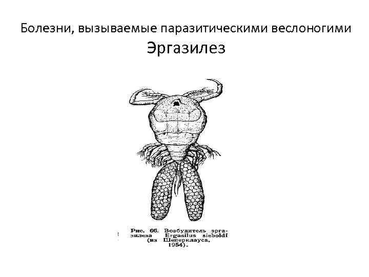 Болезни, вызываемые паразитическими веслоногими Эргазилез 