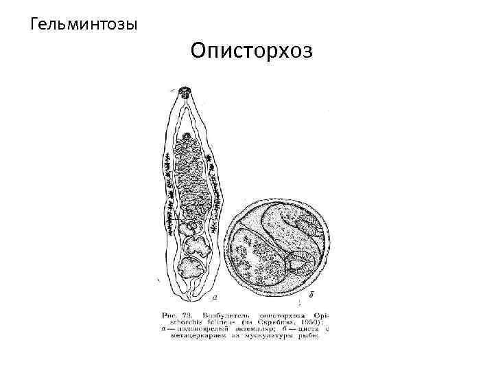 Гельминтозы Описторхоз 