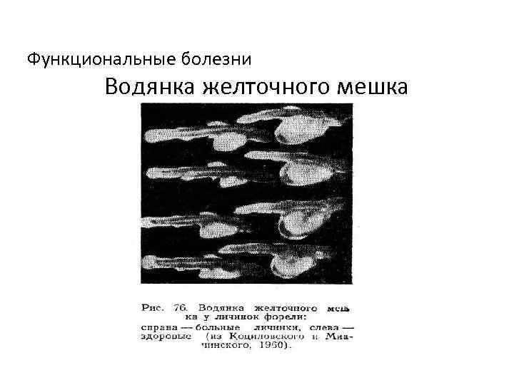 Функциональные болезни Водянка желточного мешка 