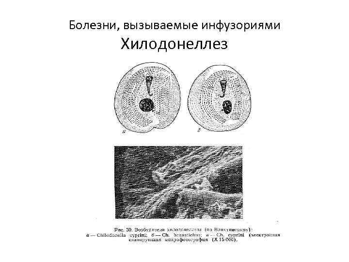 Болезни, вызываемые инфузориями Хилодонеллез 
