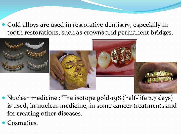  Gold alloys are used in restorative dentistry, especially in tooth restorations, such as