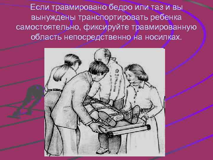 Если травмировано бедро или таз и вы вынуждены транспортировать ребенка самостоятельно, фиксируйте травмированную область