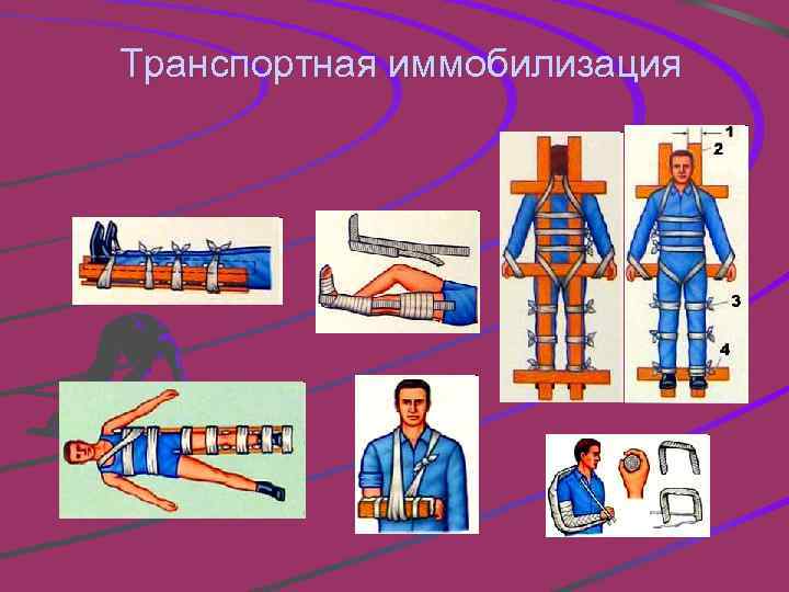 Транспортная иммобилизация 