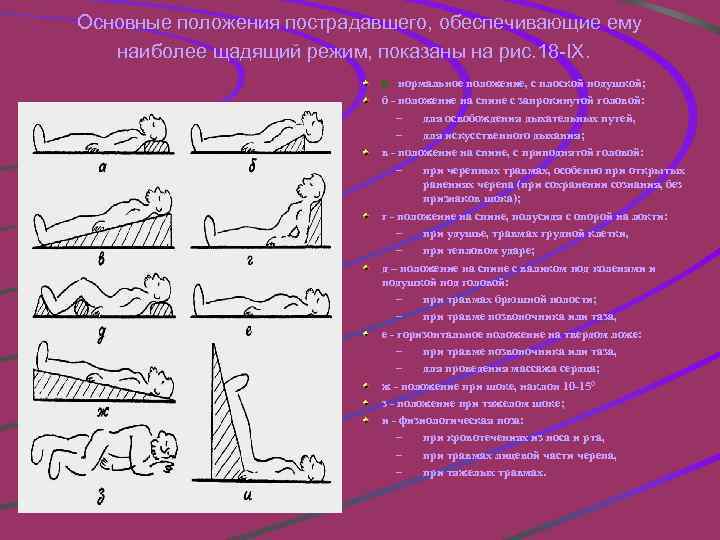 Основные положения пострадавшего, обеспечивающие ему наиболее щадящий режим, показаны на рис. 18 -IX. а