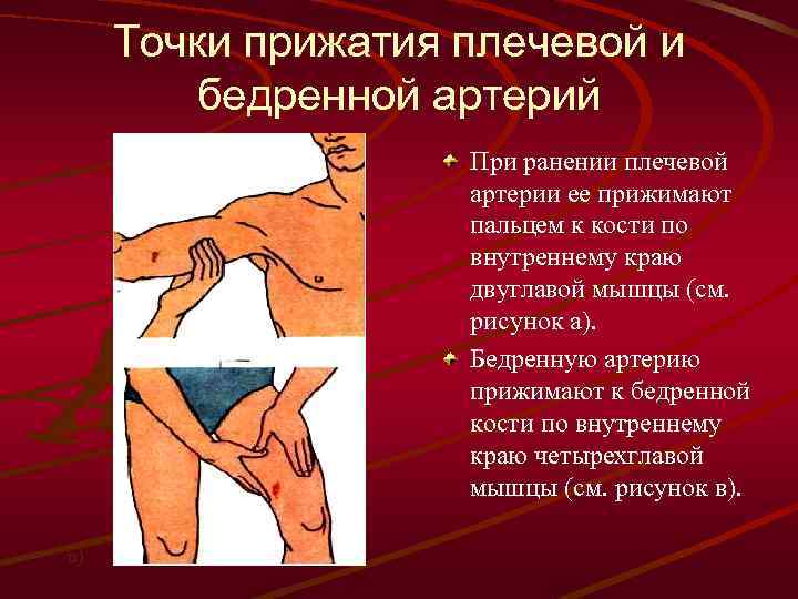 Точки прижатия плечевой и бедренной артерий а) в) При ранении плечевой артерии ее прижимают